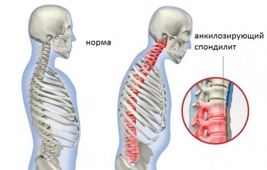 Влияние подгруппы на категорию годности