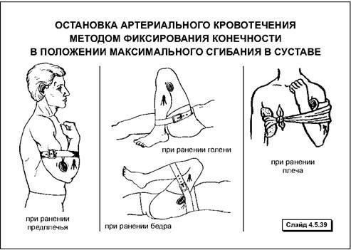 Полевая перевязка и борьба с кровотечениями: Остановка кровотечения в экстремальных условияхОвладение навыками остановки кровотечения - важнейший навык для любого солдата на передовой. В условиях, когда помощь не может быть оказана немедленно, знание того, как остановить кровопотерю, может означать разницу между жизнью и смертью. В наборе тактического медика должны быть эффективные материалы для борьбы с кровотечением в суровых условиях.