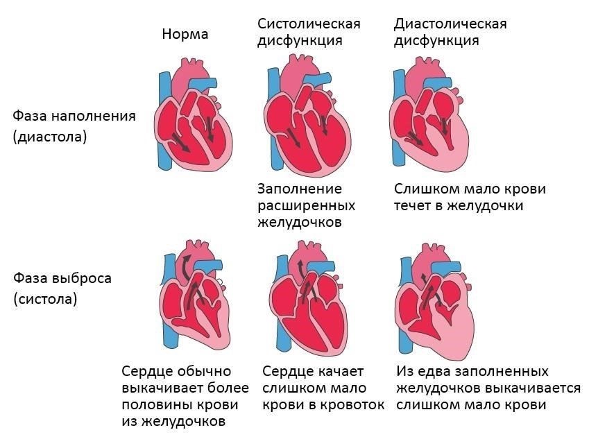 Сердечно-сосудистые заболевания, такие как тяжелая гипертония, сердечная недостаточность или аритмия, часто приводят к тому, что человеку выдается «белый билет», поскольку эти состояния представляют значительный риск при работе в физически тяжелых условиях. Хронические респираторные заболевания, такие как астма или ХОБЛ, также могут стать решающим фактором, когда физическая нагрузка, требуемая при выполнении определенных задач, превышает способность человека эффективно дышать.